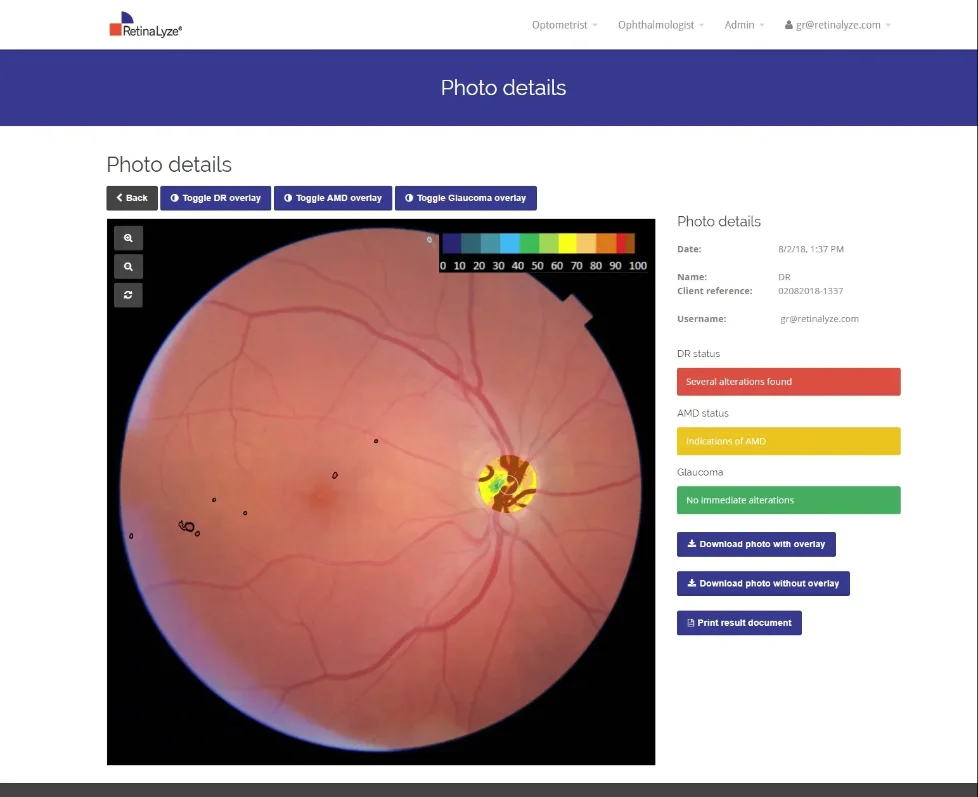 Drop a screenshot or logo — Retinalyze — 4:3
